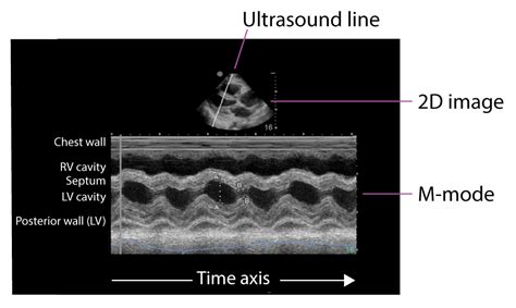 how to read an echocardiogram report|Article Contents .